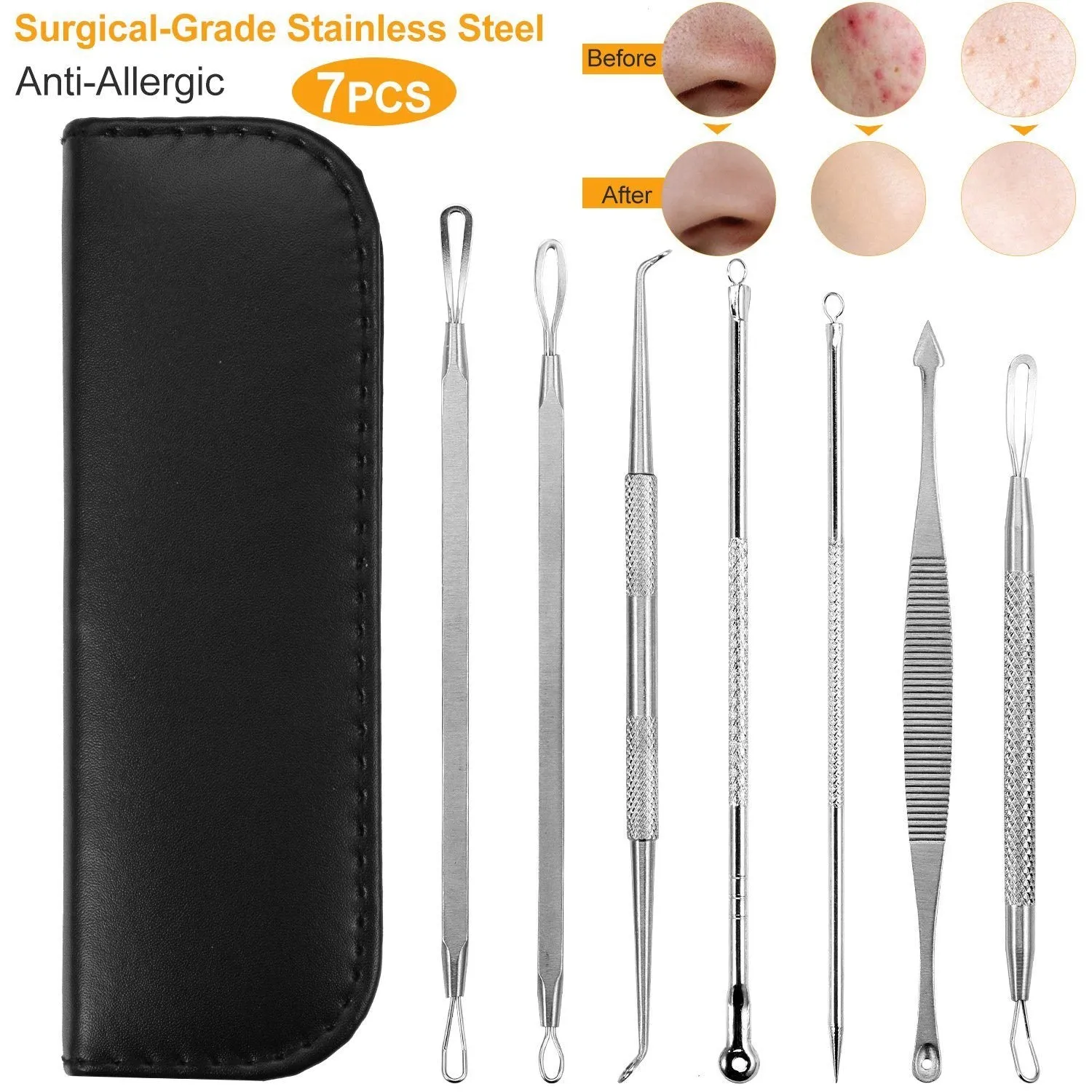 7-Pieces: Blackhead Remover Stainless Steel